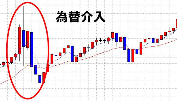 為替介入